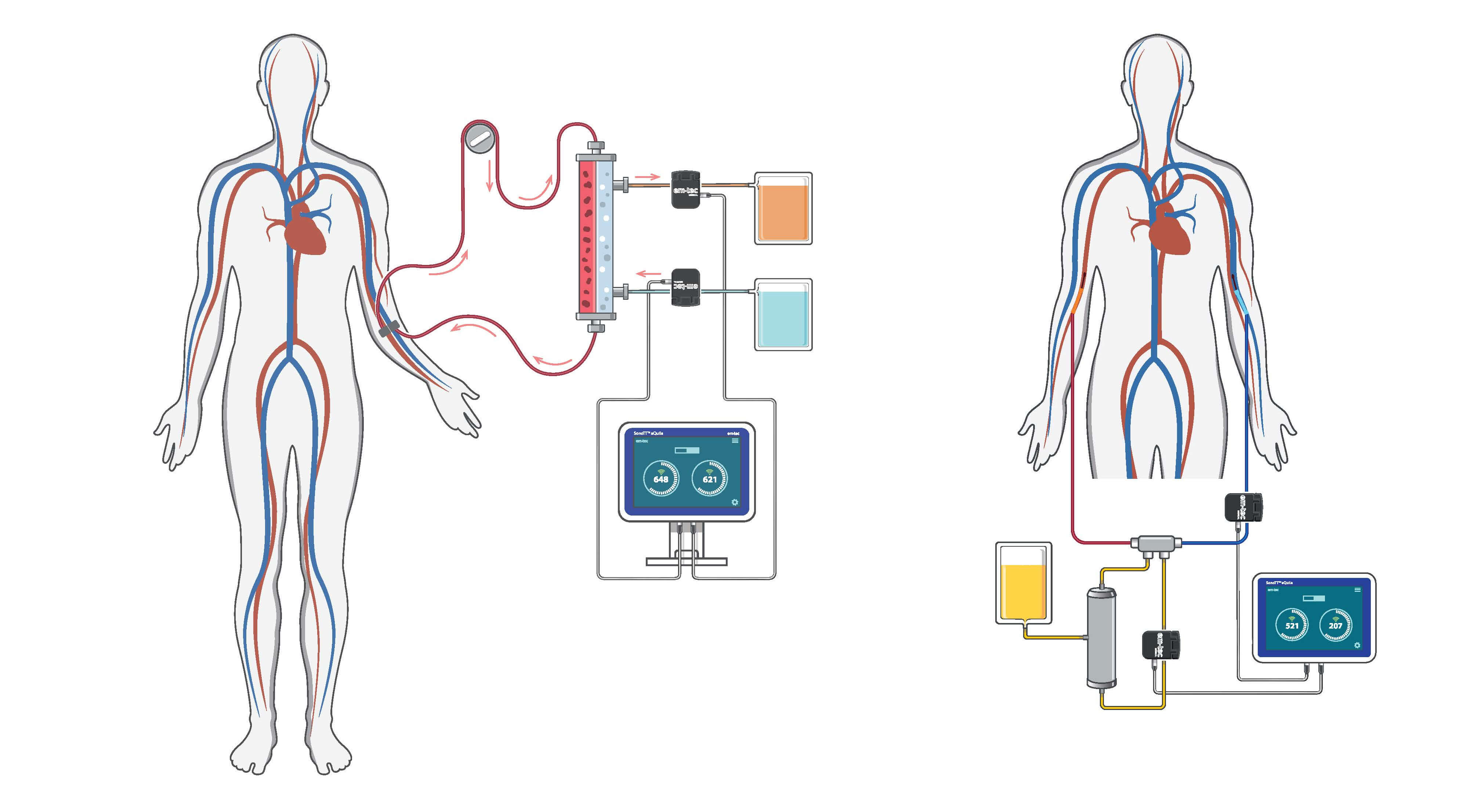 SonoTT TechNote Safety Through Flexible Measurement