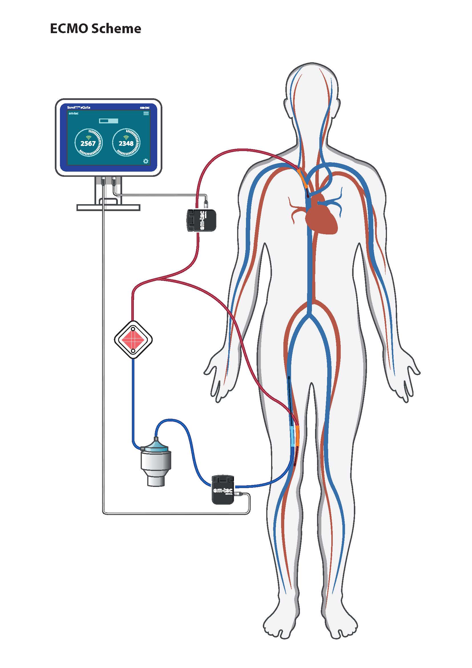 Application ECMO